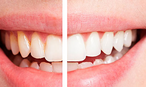 牙齒開始“衰老”的三大癥狀，你可要當心了