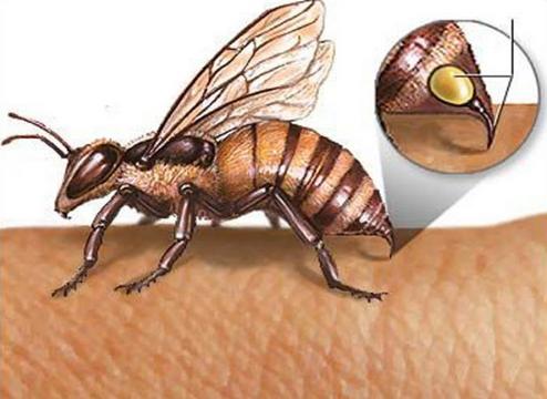 被蜜蜂蜇了如何快速有效消腫(蜜蜂蟄傷快速消腫止痛的妙招) 被蜜蜂蜇了如何快速有效消腫(蜜蜂蟄傷快速消腫止痛的妙招)